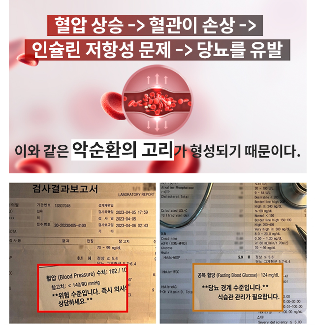 리턴큐