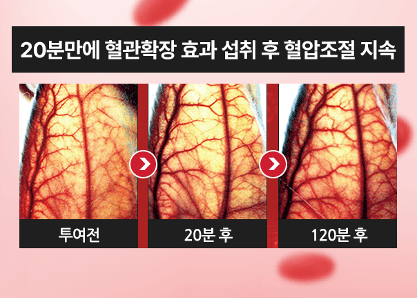 리턴큐